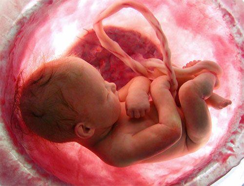 Workshop Ressonância Magnética de Placenta